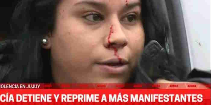 VIDEO. Una manifestante se autolesiona y se muestra como víctima de represión 